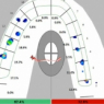 T-Scan Training Level 1 Video: Center of Force