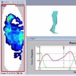 F-Scan & the Gait Cycle Video