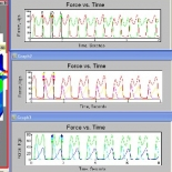 Improve Asymmetrical Gait Using F-Scan - 3 Box approach