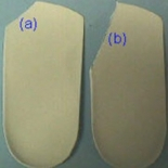 Hallux Limitus Treatment - Identifying Functional Hallux Limitus