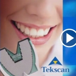 Introducing T-Scan 7 software