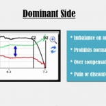 T-Scan Training Level 2 Video: Evaluating Closures Part III