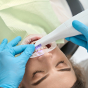 intraoral scanner