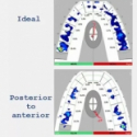 T-Scan Training Level 2 Video: Evaluating Closures Part II