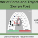 T-Scan Training Level 2 Video: Evaluating Excursions Part II