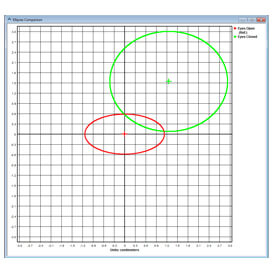 Using Sway Analysis to Treat Postural Misalignments