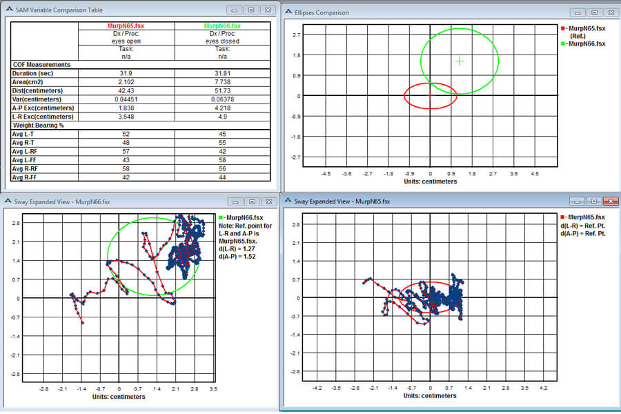 Sway Analysis Module