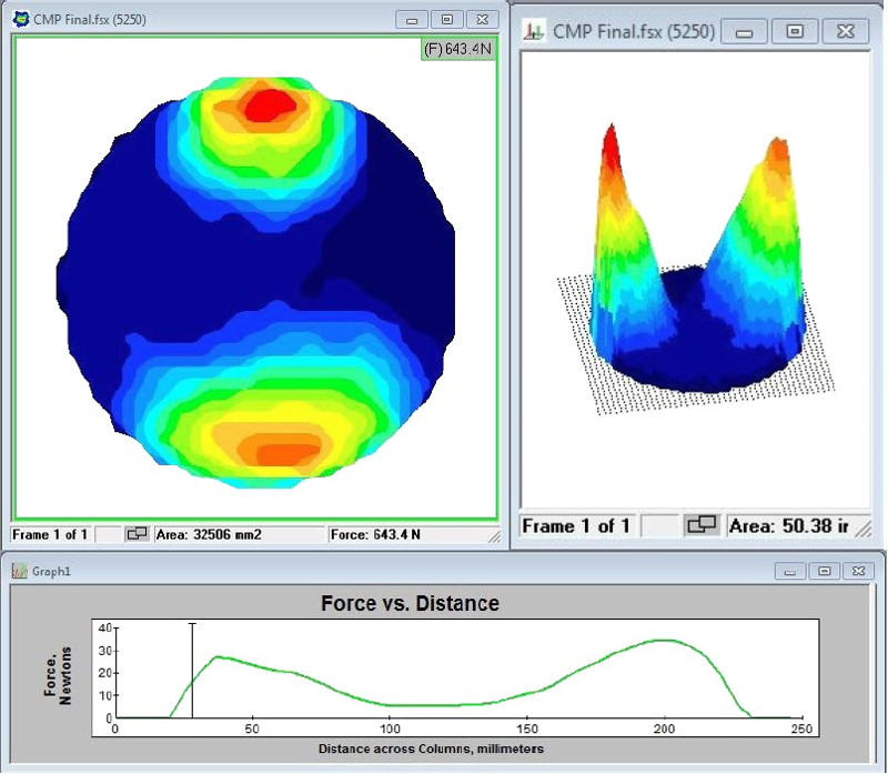 Wafer pressure profile: non-uniform material removed is likely due to an uneven pressure on the wafer from the polishing head- higher pressure applied on the two lobes of the polishing head.