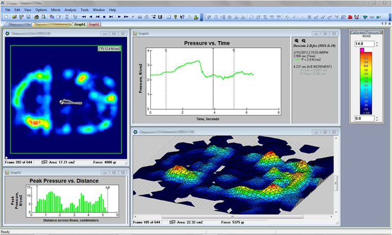 Wearable Monitoring Device Ergonomics